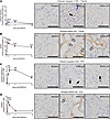 Renal IRI induces unique patterns of caspase-3–dependent apoptosis and necr