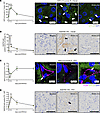 Renal IRI induces autophagy in tubules and peritubular capillaries (PTCs).