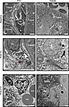 Caspase-3–dependent apoptosis, necroptosis, and autophagy in renal tubules