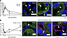 Chloroquine (CHQ) inhibits autophagy following renal IRI.