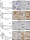 Autophagy disruption enhances apoptosis of peritubular capillaries (PTCs) f