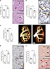 Autophagy disruption aggravates microvascular rarefaction and fibrosis foll