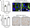 Concomitant autophagy disruption and caspase-3 deficiency enhance necroptos