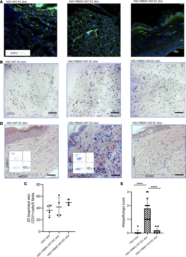 Vitality, vascularization, and rejection assessment of 3D-printed skin g...