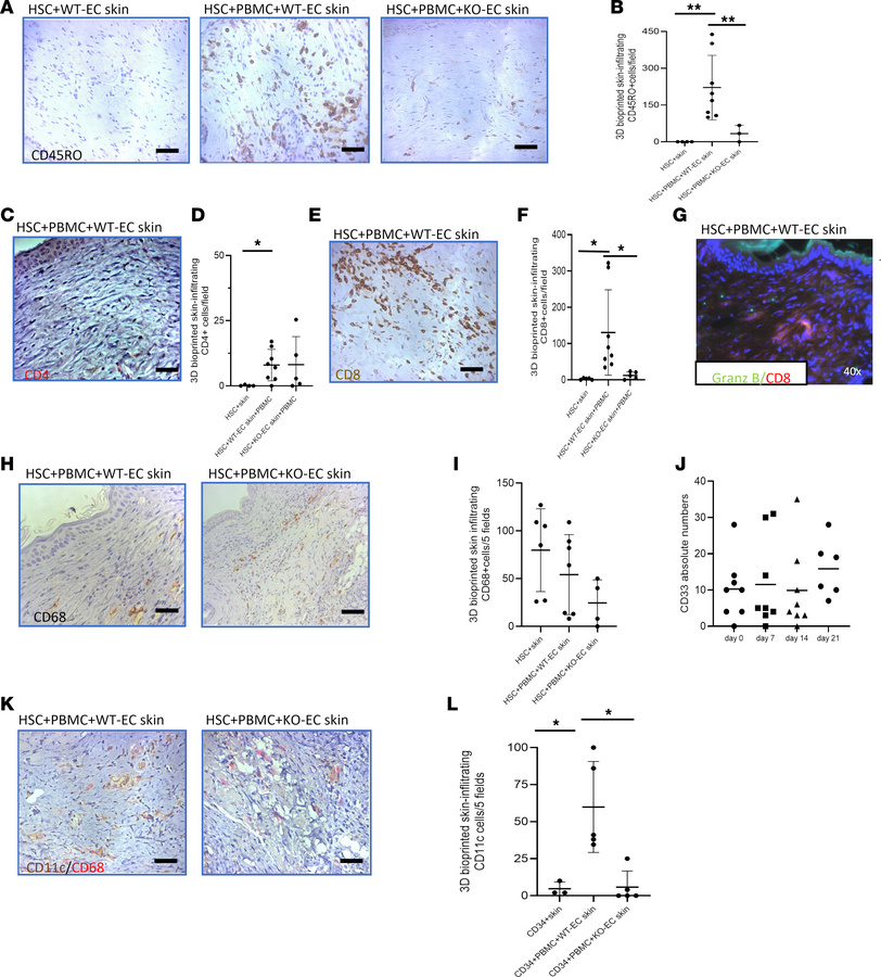 3D-printed skin-infiltrating cells.
(A and B) IHC staining of CD45RO sho...