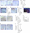 3D-printed skin-infiltrating cells.