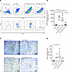 Characterization of spleen-infiltrating human cells.