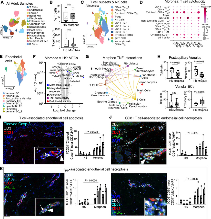 Cytotoxic Trm induce endothelial injury and necroptosis in morphea skin ...