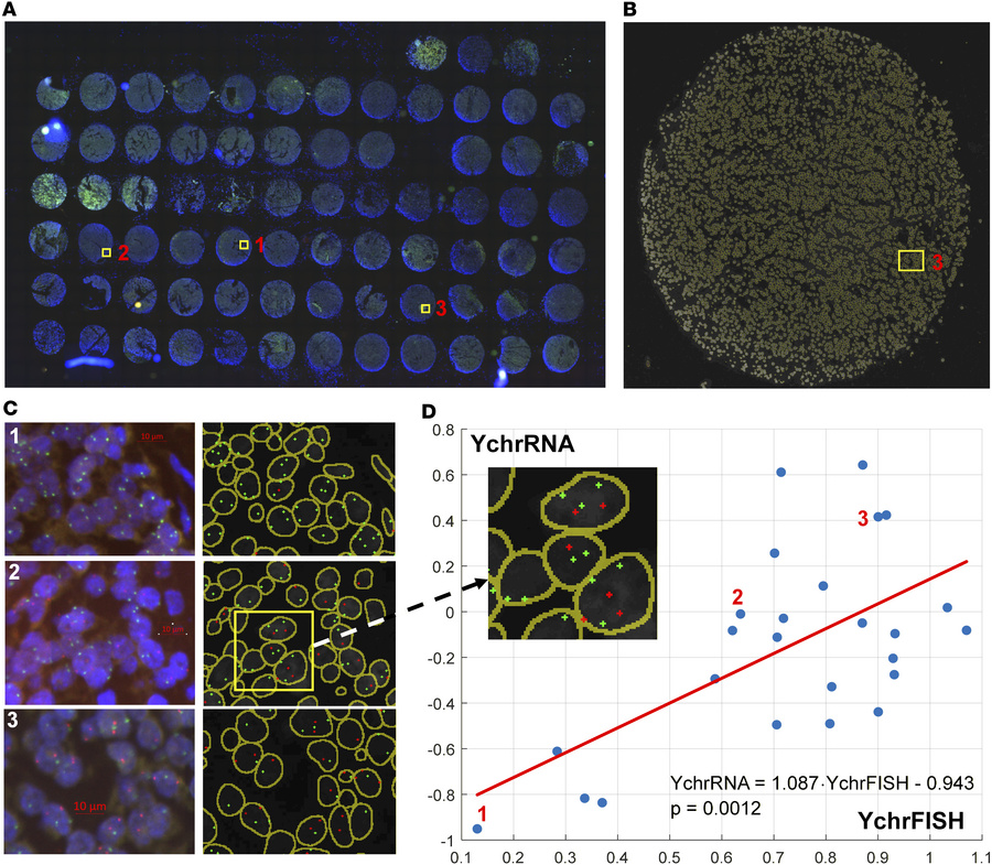 Positive correlation between FISH-based chromosome Y score (YchrFISH) an...