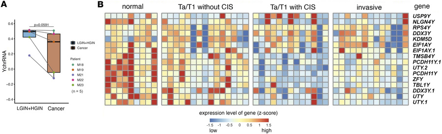 Reduced Y-chromosome RNA signature during urothelial transformation.
(A)...