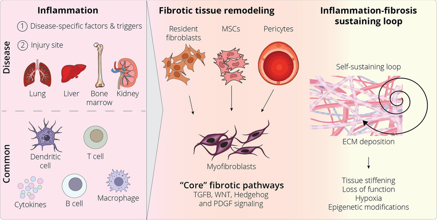 Graphical overview of the inflammation/fibrosis cycle across organs.