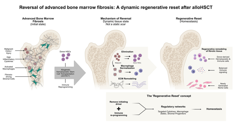 The regenerative reset of BM fibrosis following allo-HSCT.
The pathologi...