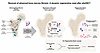 The regenerative reset of BM fibrosis following allo-HSCT.