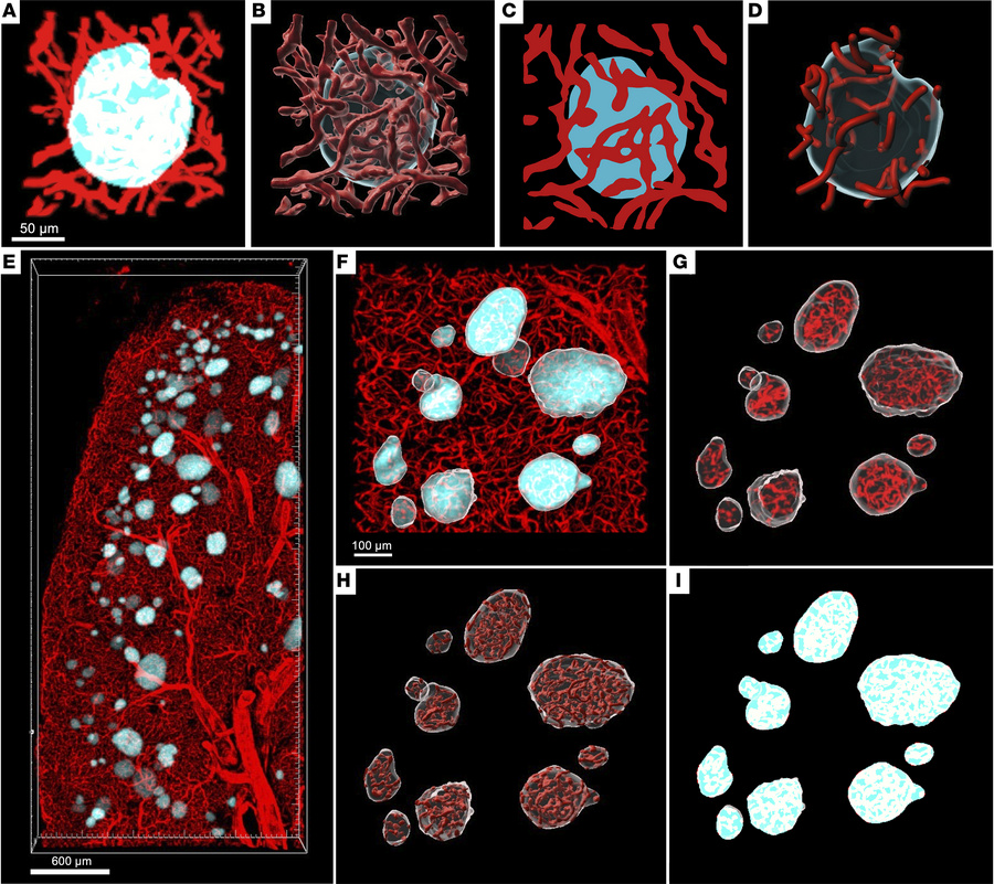3D reconstruction of islets and their microvasculature.
(A) Top-down 3D ...