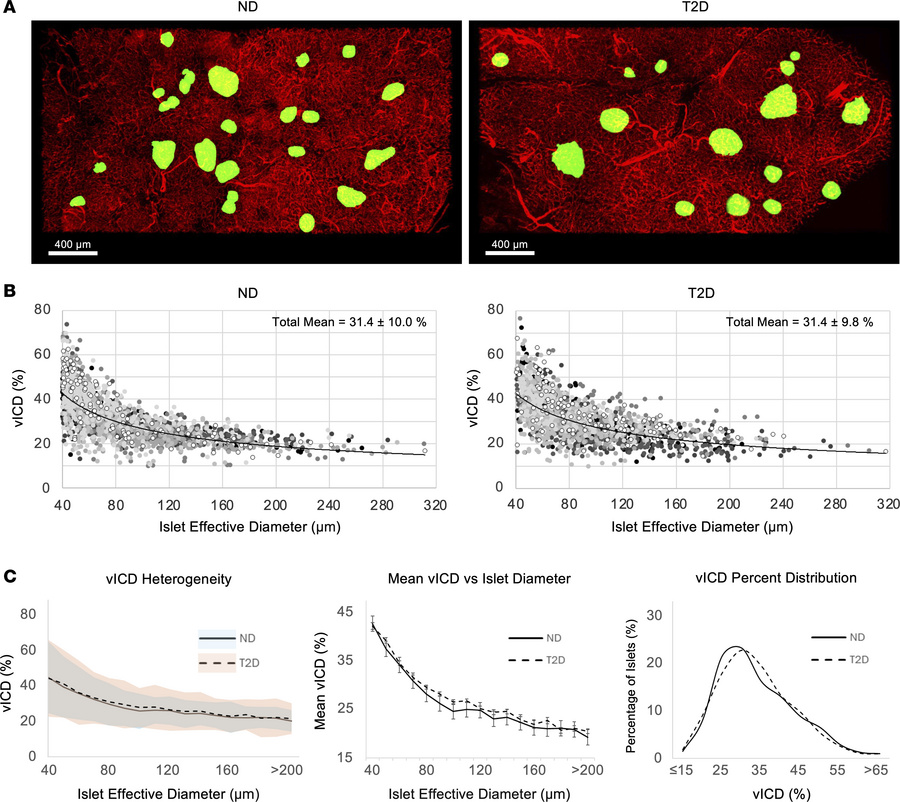Comparison of vICD between ND and T2D human subjects.
(A) Representative...