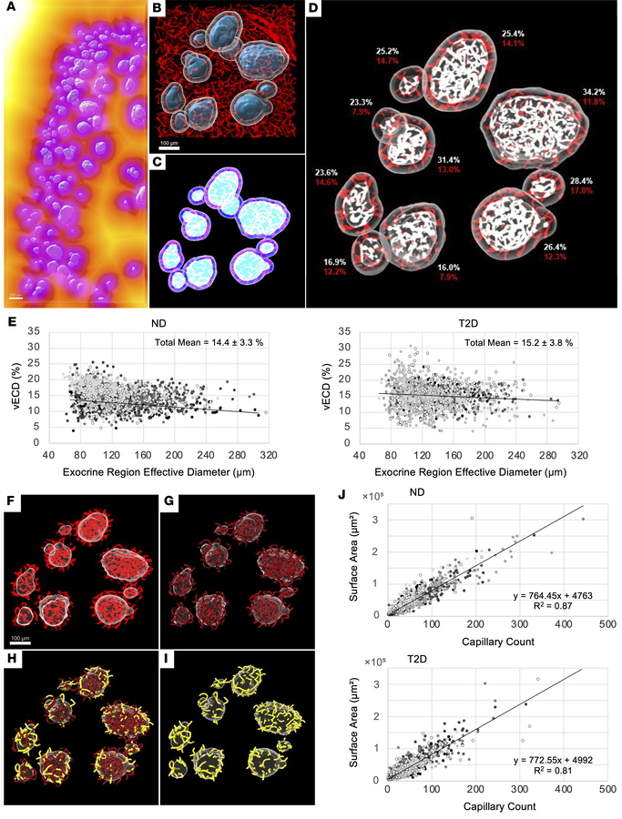 Comparison of peri-islet vECD and interface capillary counts between ND ...
