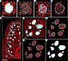 3D reconstruction of islets and their microvasculature.