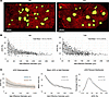 Comparison of vICD between ND and T2D human subjects.