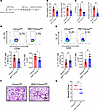 Deletion of α7 nAChR on Mks alleviates HDM-induced type 2 airway inflammati