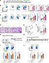 α7 nAChR agonist GTS-21 aggravates papain-induced airway inflammation.