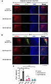 MTII-stimulated cFos expression in MC4R-expressing neurons of the PVN.