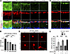 LIFR expression in RGCs.