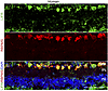 LIFR expression in human RGCs.