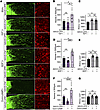 AAV2-LIFR enhances RGCs’ responsiveness to unrelated trophic factors.