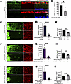 LIFR knockdown suppresses optic nerve regeneration.
