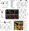 Myeloid-derived Cst3 alters cardiac fibrosis.