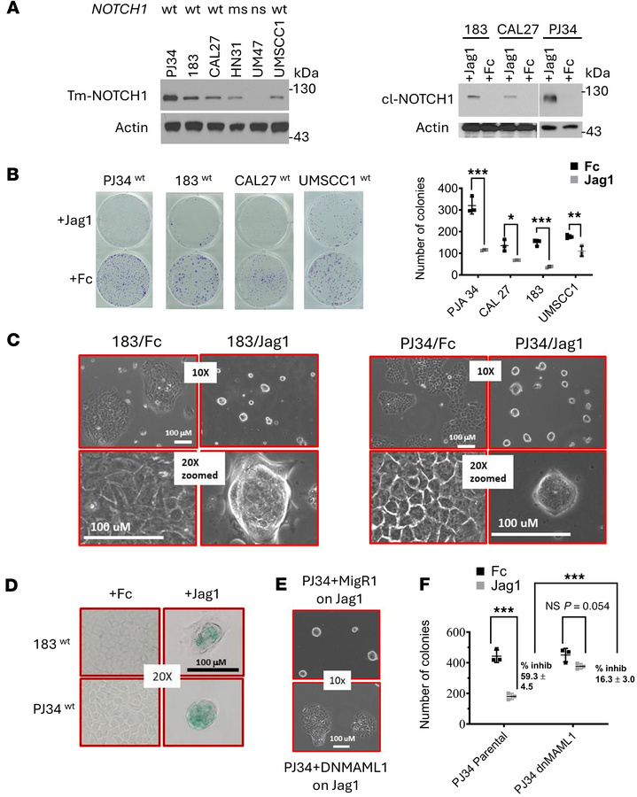 NOTCH signaling alters cell morphology and inhibits growth in 2-dimensio...