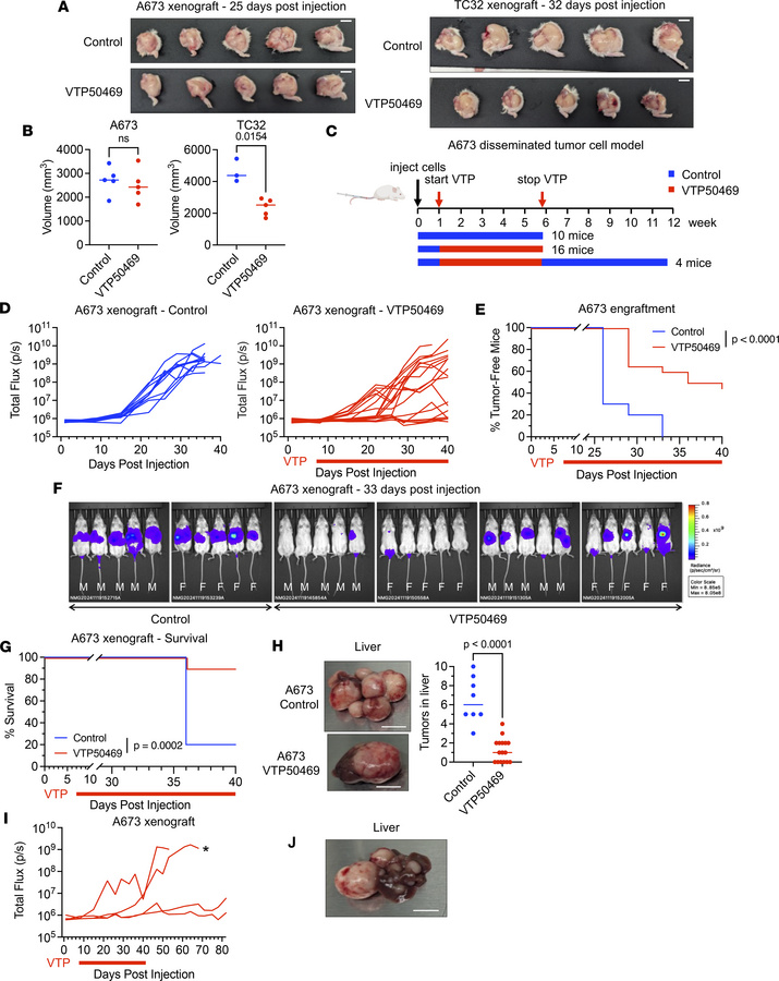 Menin inhibition reduces colonization in EwS xenografts.
(A) Photos of p...