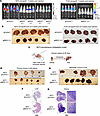 Menin promotes colonization and metastasis.