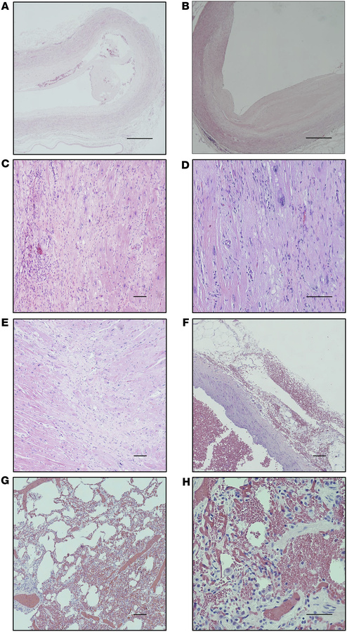 Pathological findings in apixaban-treated rhesus macaques.
One RM experi...