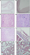 Pathological findings in apixaban-treated rhesus macaques.