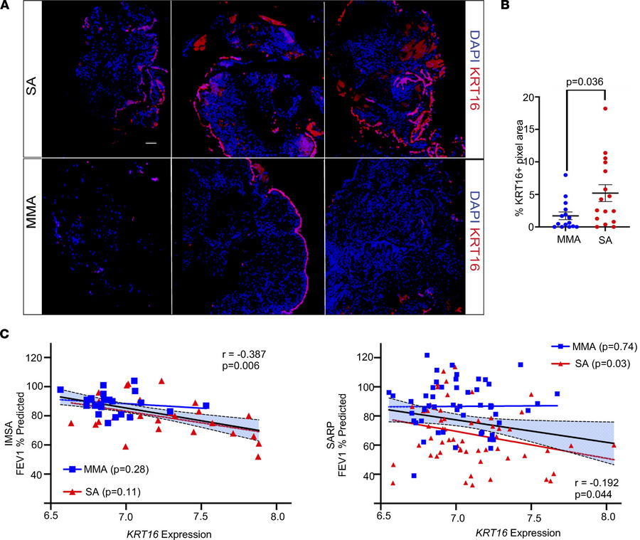 KRT16 protein expression in patients with asthma in the airways of IMSA ...