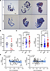 Collagen deposition in endobronchial biopsy specimens from patients with as