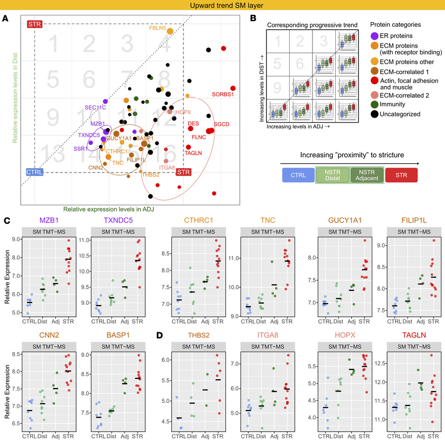 ER-, ECM-, and muscle-associated proteins are characterized by progressi...