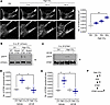 High CO2 promotes STIM1 puncta formation via ERK-mediated phosphorylation.