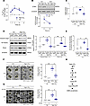 High CO2 induces ERK-dependent STIM1 signaling required for ASM contraction