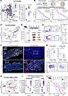 IL1RAP-expressing myeloid-stromal networks are a therapeutic barrier in PDA