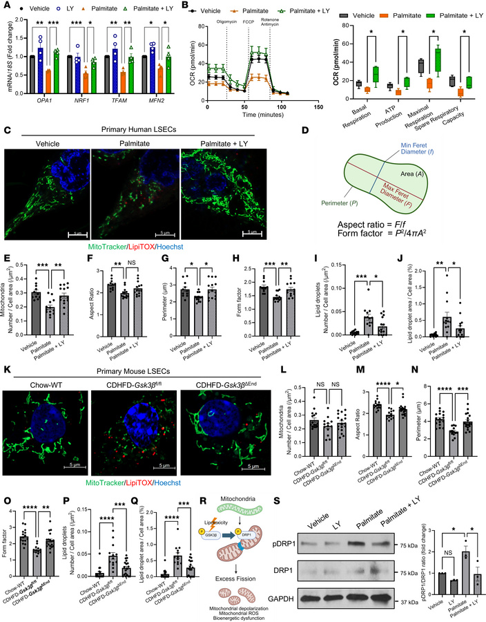 GSK3 inhibition protects LSEC against lipotoxicity-induced mitochondrial...