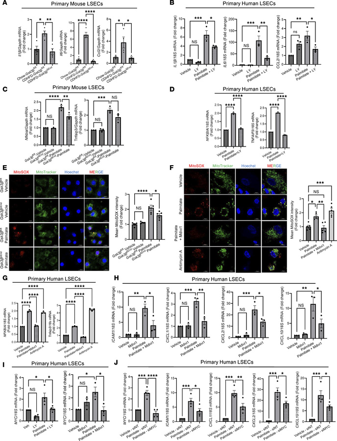 LSEC mitochondrial dysfunction drives inflammation in lipotoxicity and M...