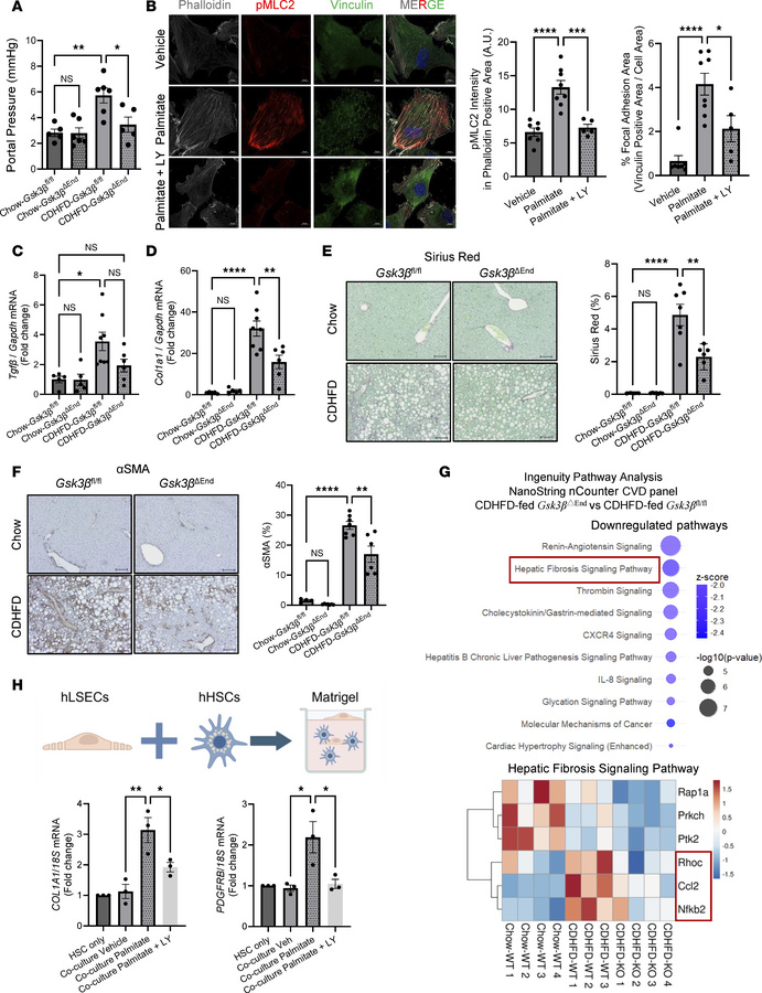 Endothelial cell–specific Gsk3β deletion attenuates liver fibrosis in mu...