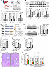 Endothelial cell–specific Gsk3β deletion does not alter the metabolic pheno