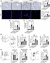 Endothelial cell–specific Gsk3β deletion attenuates liver inflammation by s