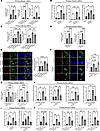 LSEC mitochondrial dysfunction drives inflammation in lipotoxicity and MASH