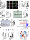 Endothelial cell–specific Gsk3β deletion attenuates liver fibrosis in murin