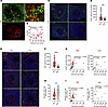 Localization of HIV-infected cells and MDSCs within lymph nodes of VIR and