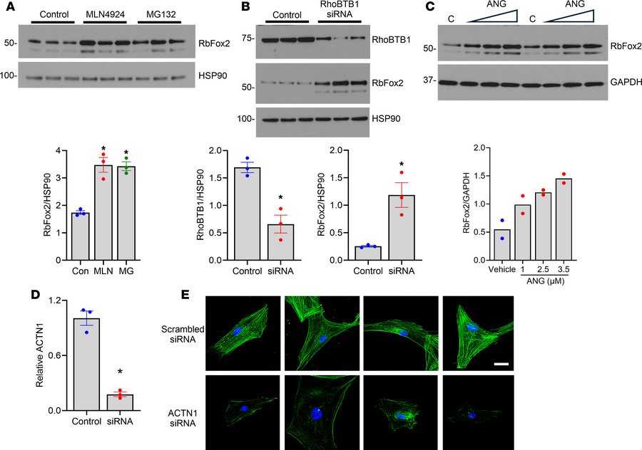 Role of RbFox2 and Actn1 in primary human aortic SMCs.
(A) Immunoblot de...